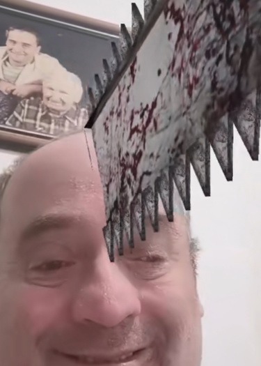 1/4 инсульта